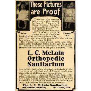  1911 Ad L. C. McLain Sanitarium Club Foot Girl Edna 