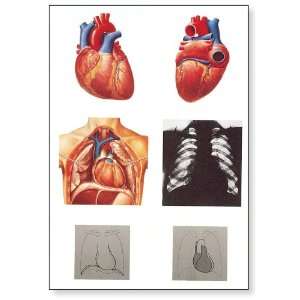 3B Scientific V2053U The Heart I Anatomy Chart, without Wooden Rods 