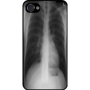  Rikki KnightTM Chest X Ray Rubber Black iphone Case (with 