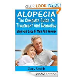 Alopecia The Complete Guide On Treatments and Remedies Stop Hair Loss 